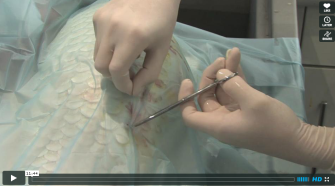 Хирургия карпов кои (видео)